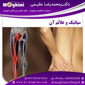 بهترین-دکتر-برای-درمان-سیاتیک