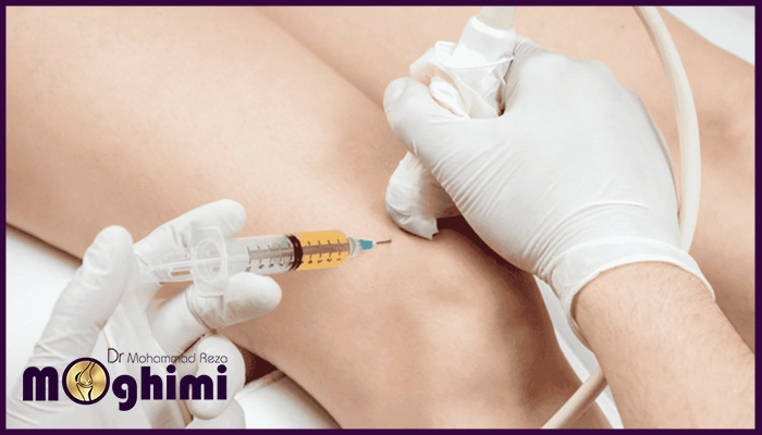 پی آر پی زانو چیست؟