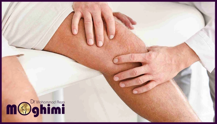 خصوصیات بهترین جراح تعویض مفصل زانو